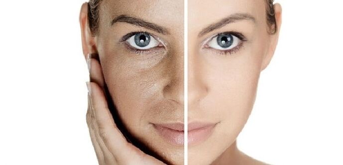 przed i po odmłodzeniu skóry twarzy