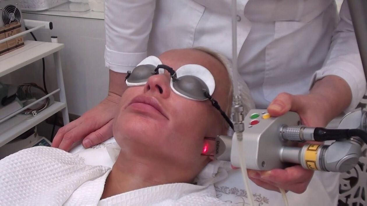 Zabieg wiązką lasera na problematyczne obszary skóry twarzy